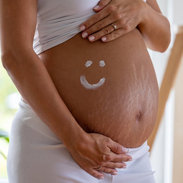 Как избавиться от растяжек во время беременности и помогут ли масла и кремы