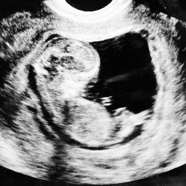 Дочь беременна в 15 лет: безопасно ли рожать в таком возрасте?