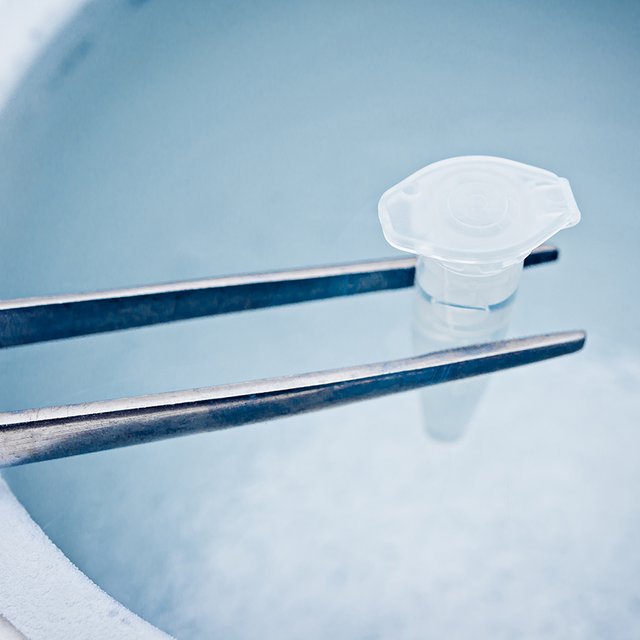 Отложенное материнство: кому нужна заморозка яйцеклеток, как она проходит и сколько стоит