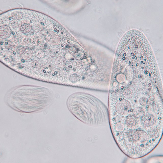 Что такое инфузория-туфелька? Каверзный тест из 10 вопросов, который определит уровень вашей эрудиции