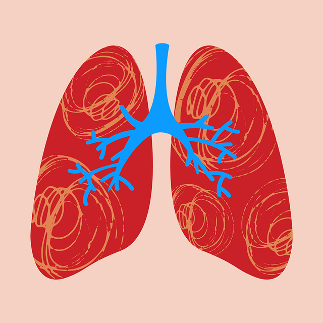 «Горе ребенку, лобик которого соленый на вкус». Как врачи открыли еще одну генетическую болезнь