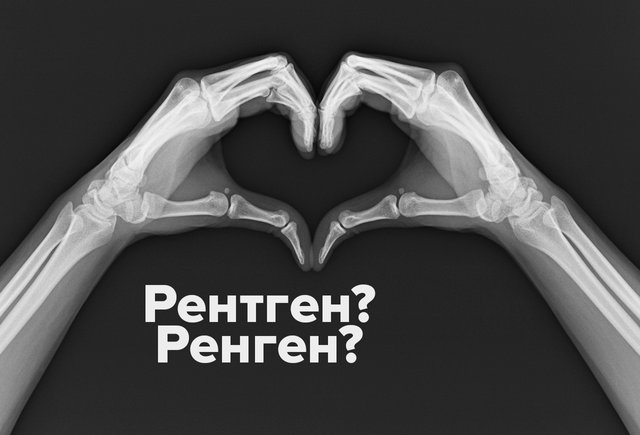 Отправляют «на ренген» или «на рентген» — как писать правильно