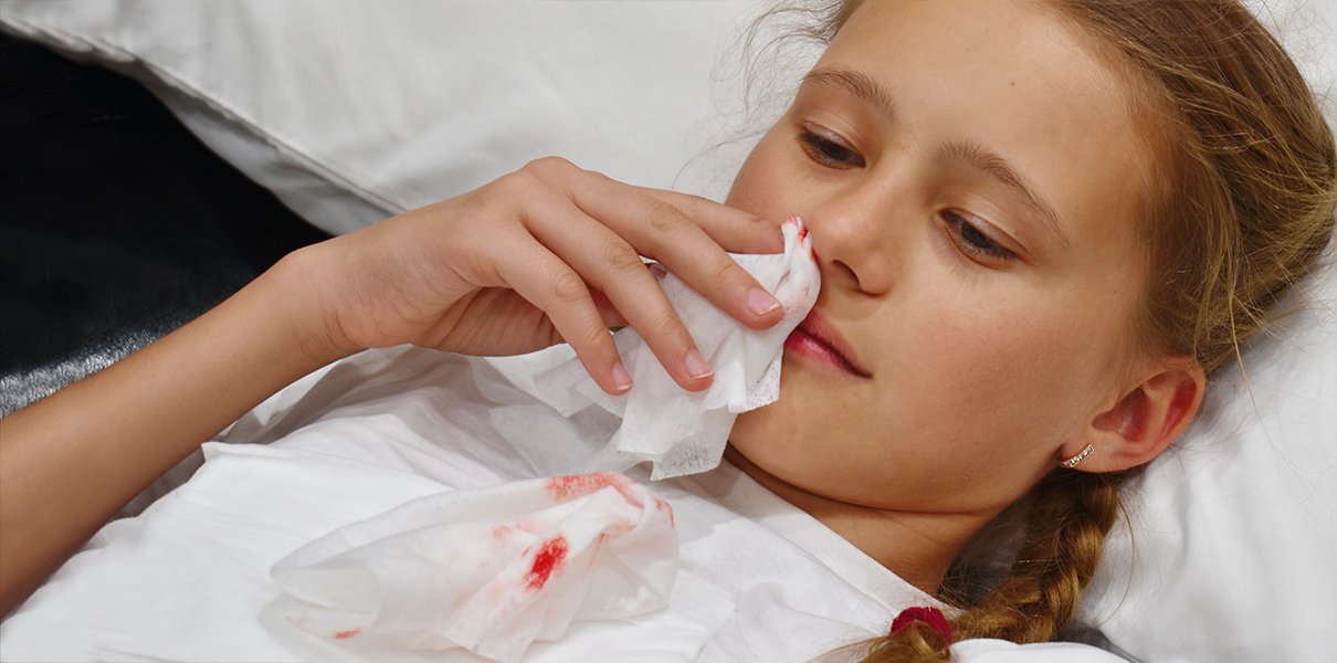 Кровь из носа у ребенка: причины и что делать