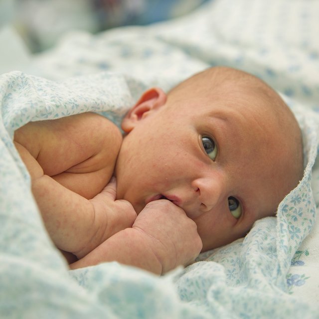 Что такое потница, как отличить её от аллергии или инфекции и нужно ли лечить