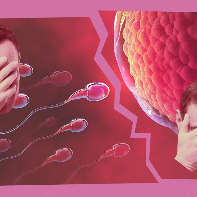 9 вопросов о мужском бесплодии: отвечает уролог