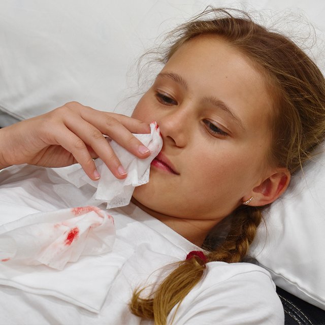У ребёнка идет кровь из носа: почему это происходит и как ему помочь?