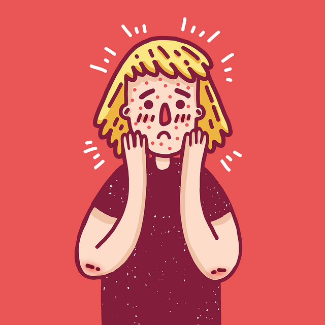 Что делать, если подросток выдавливает прыщи и не контролирует себя?