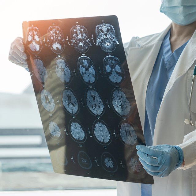 Вспышка менингита в Подмосковье: что случилось, как не заразиться и передаётся ли инфекция через посылки