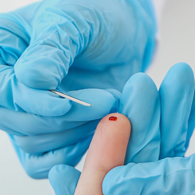 «Представь, медсестра колет всех одним пером»: почему в детской поликлинике брали кровь одним инструментом и какие риски с этим связаны