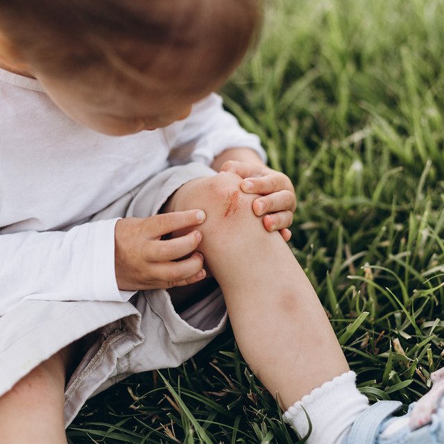 Зелёнка не помогает, а йод может быть опасен — всё, что вы не знали про синяки, ушибы и ссадины