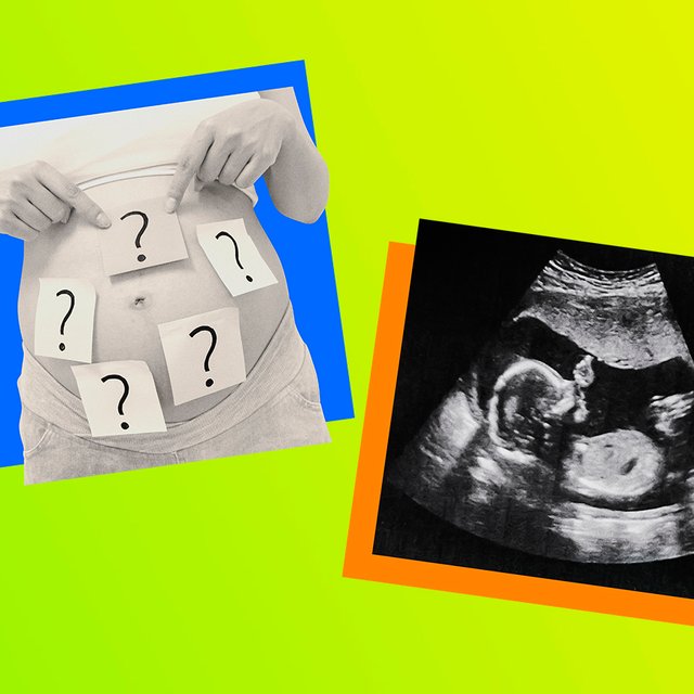 Ребёнок в утробе матери правда покрыт шерстью? Тест: правда или миф про беременность