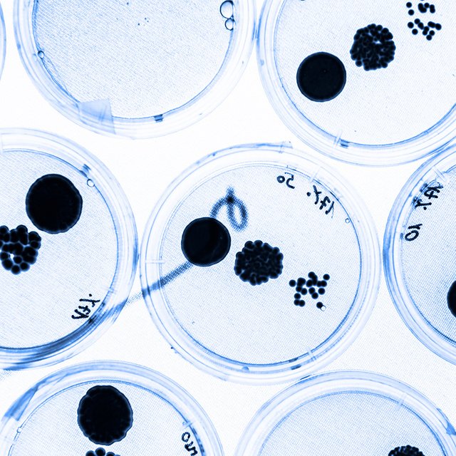 Новая инфекция из Китая? Что такое микоплазменная пневмония – в этом году ей стали массово болеть дети