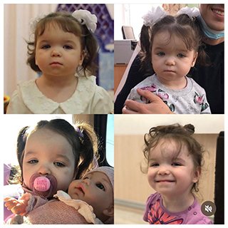 Родители сделали коллаж из фото — какой была Наташа до и после того, как стала жить в семье.