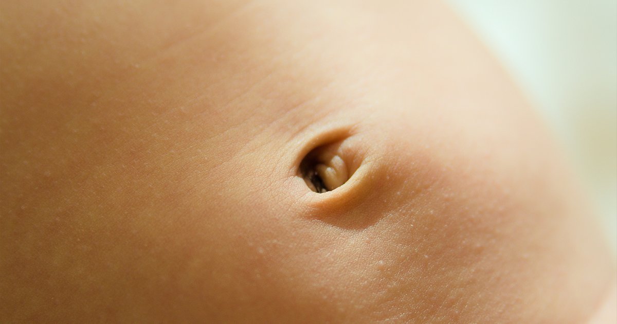 Ребенку 4 года болит пупок. Омфалит новорожденных омфалит.