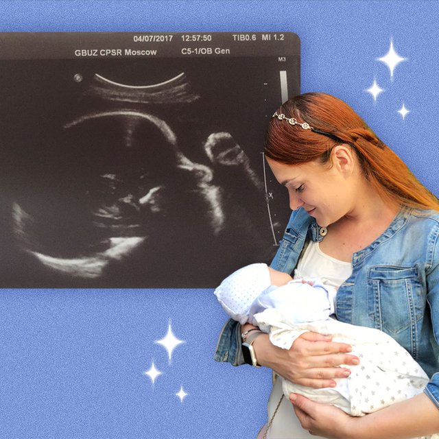 «Пять месяцев ждала, разрешат ли рожать». Монолог мамы, которая трижды решилась на беременность с большими рисками