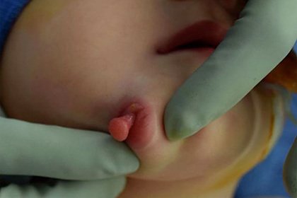 Фото: Hamberis et al / BMJ Case Reports