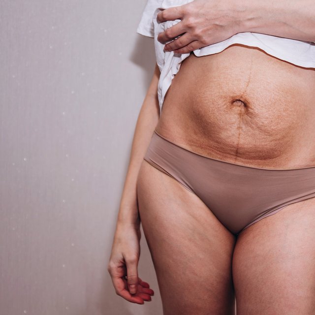 Как перестать ненавидеть свое тело после родов?