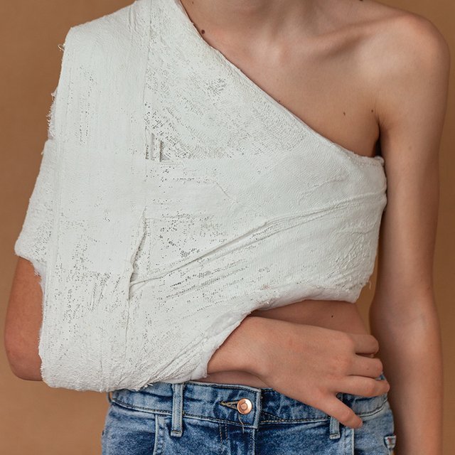 У ребёнка перелом со смещением: когда можно снова заниматься спортом