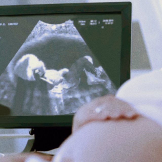 «Пусть родится мальчик». Что такое селективные аборты и где запрещают узнавать пол ребёнка по УЗИ