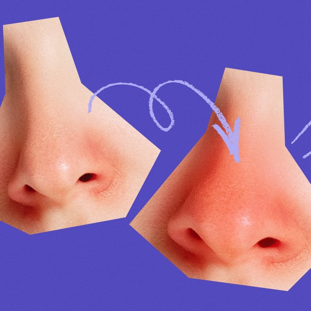 6 внешних признаков будущих мам, или Что такое «беременный нос»