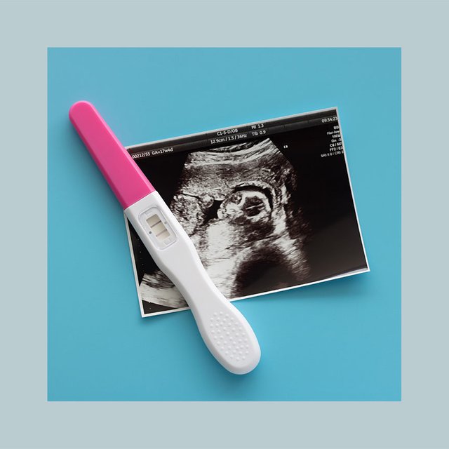 Как в регионах работает запрет на склонение к абортам и что будет, если его нарушить