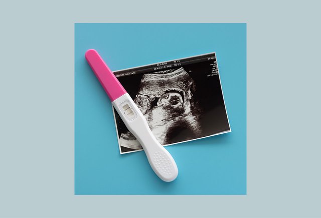 Как в регионах работает запрет на склонение к абортам и что будет, если его нарушить