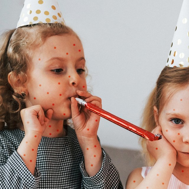 Ветряночные вечеринки: что это такое, кто и зачем водит туда детей и что об этом говорят врачи