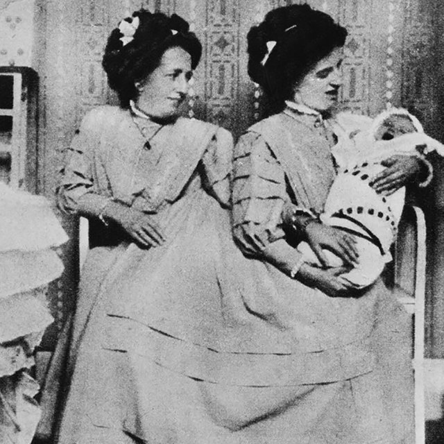 Беременность на двоих: история сиамских близнецов, одна из которых стала мамой