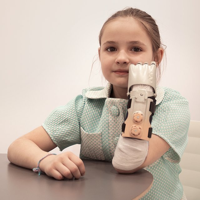 «Смотри, терминатор пришёл!». История Оксаны – 8-летней девочки, у которой вместо руки протез