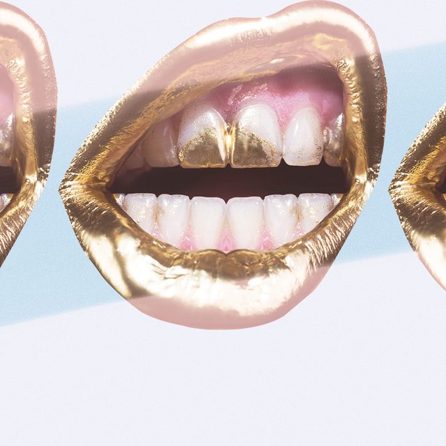 Подровнять зубы пилкой: 9 опасных трендов, захвативших подростков