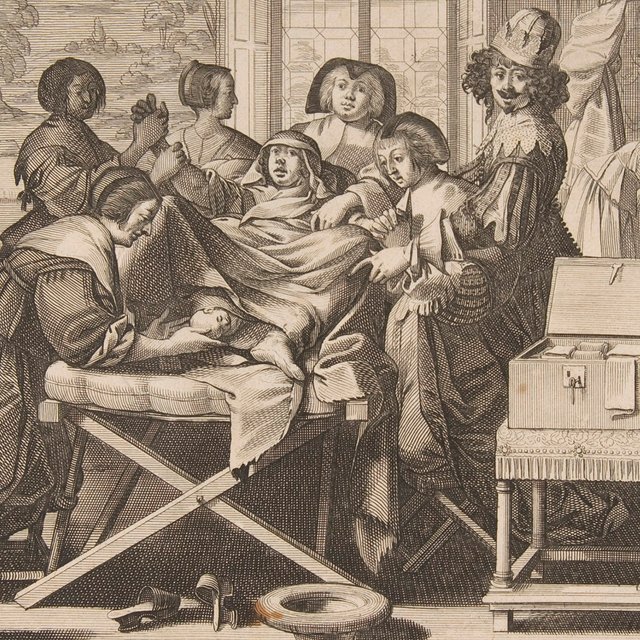 «Заклятия, чтобы изгнать демона». Почему обезболивать роды начали только в середине XX века и что было до этого