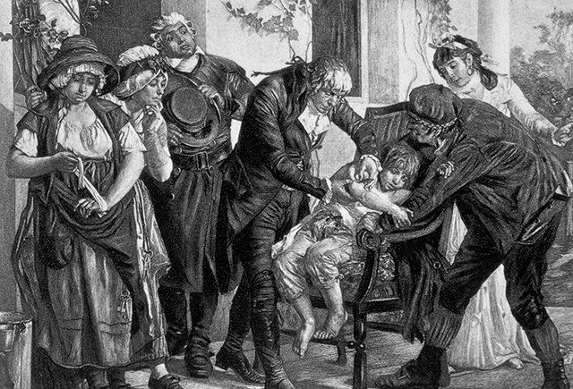 YourForum - Gallery - Viewing image - SF34880 Small Boy Suffering from Smallpox