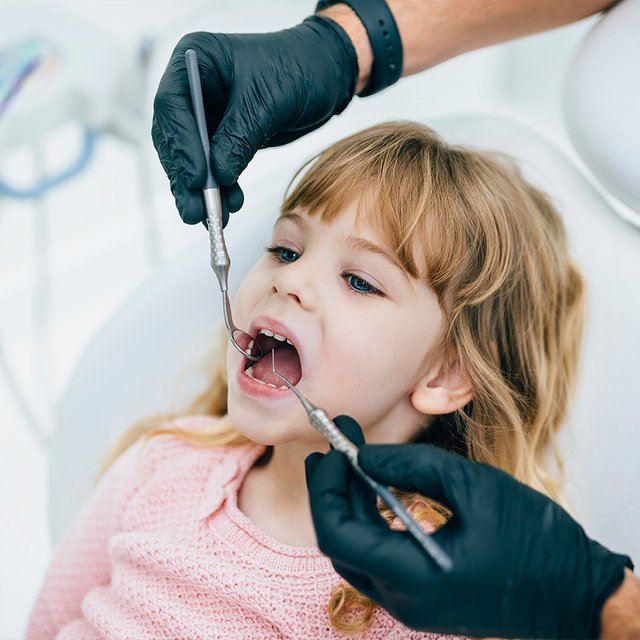 Налёт на зубах у ребёнка: из-за чего появляется и чем опасен