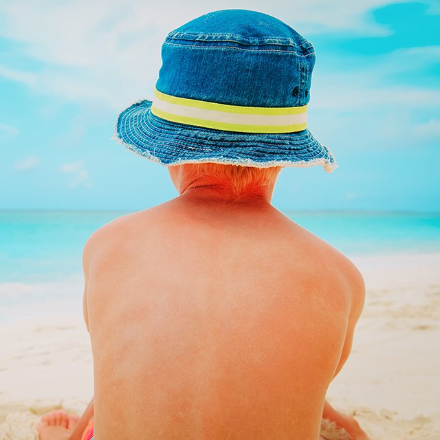 Как понять, что у ребёнка аллергия на солнце?