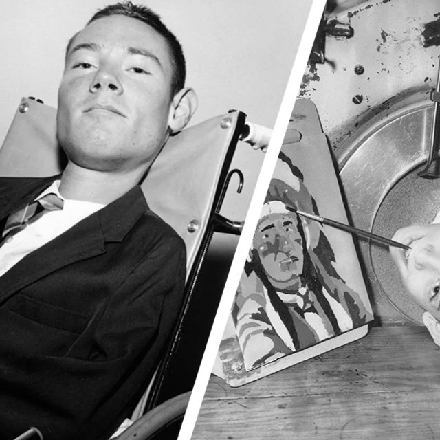 Человек с «железными лёгкими»: история одной из последних жертв полиомиелита
