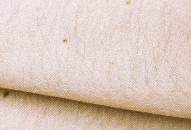 Я девочка, а у меня растут волосы на животе и плечах! Что делать?