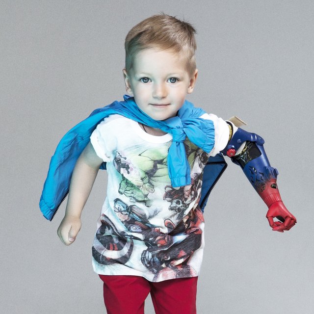 "Сделаем крутой цветной протез, будешь звездой в школе": как робототехника помогает особенным детям