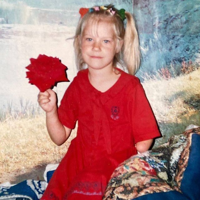 «Родители комплексовали из-за меня». Девушка, которая родилась без руки, — о своём детстве