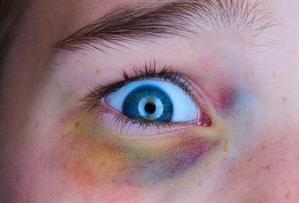 Ребенка бьют в школе, что делать родителям