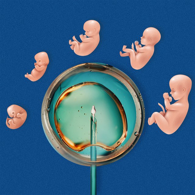 «А вдруг пробирки перепутают?» 11 нестыдных вопросов про ЭКО: отвечает репродуктолог