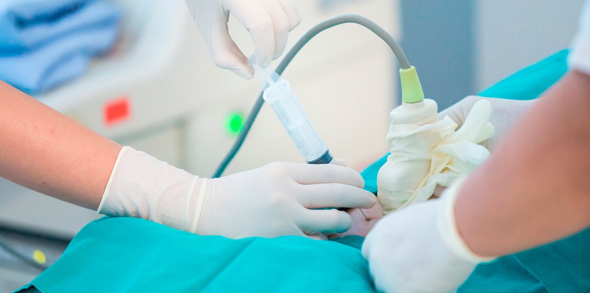 Что такое забор околоплодных вод у беременной, зачем он нужен и не ...