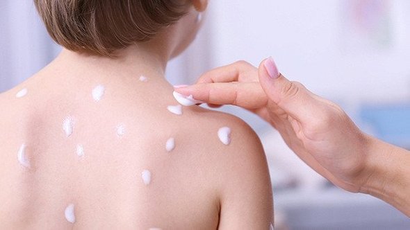 Атопический дерматит рекомендации по уходу за кожей