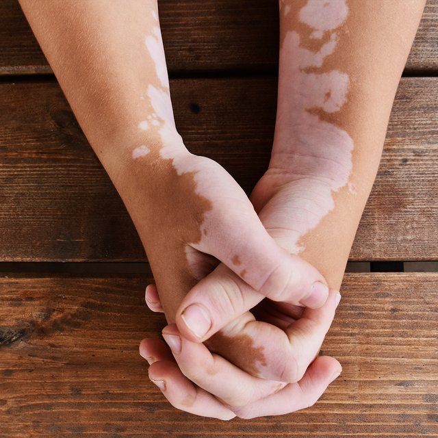 У ребёнка есть особенности внешности: как научить его реагировать на вопросы об этом