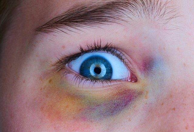 «Моего ребенка бьют в школе». Что должен делать родитель, чтобы не допустить безнаказанности