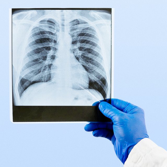 «Табачные компании ставят эксперименты над детьми»: пульмонолог — о «болезни вейперов» и других патологиях легких