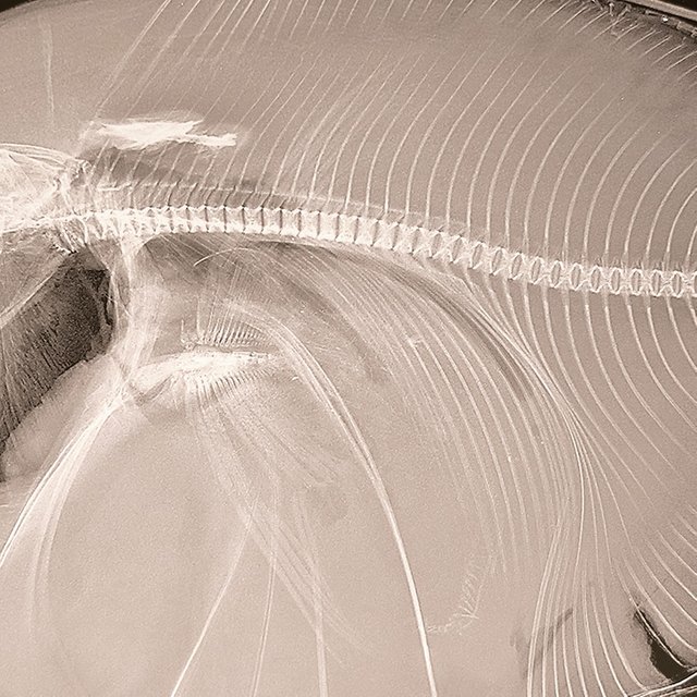 Рыбьи кости вместо игл: как российские крестьяне придумали прививки до врачей и что случилось дальше